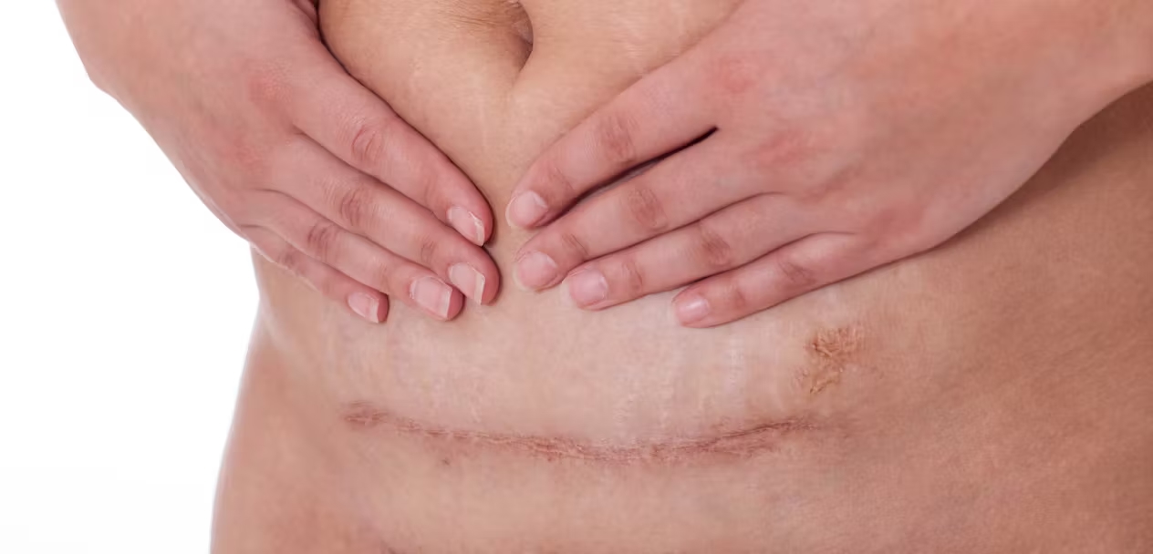 ScarWork healing example